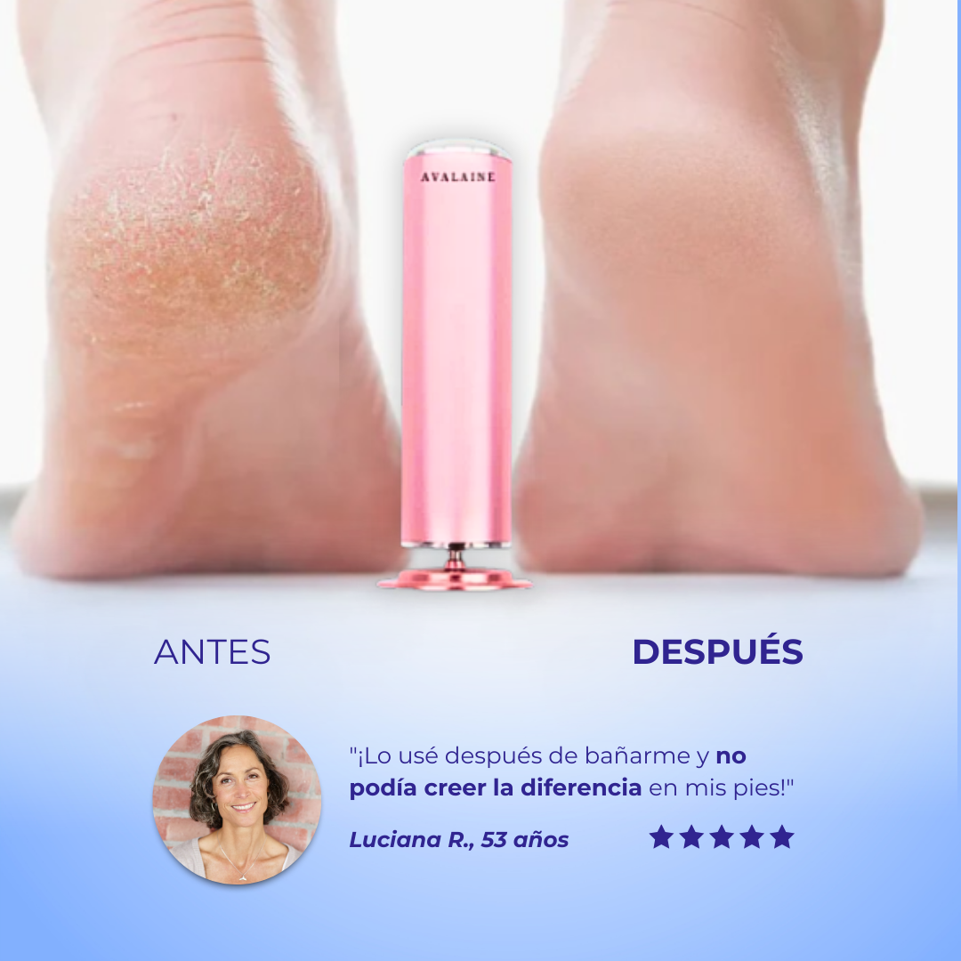 FootZen™ - Suaviza la piel y reduce tus callos desde el primer día
