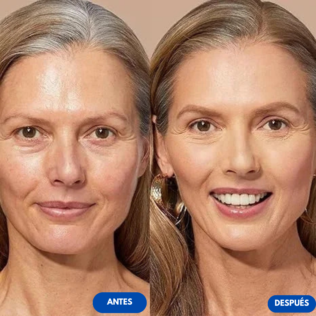 Sanorys Botagus™ - Base 4 en 1 con Protección Solar | CURSO + SÉRUM HIDRALIFT GRATIS