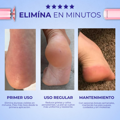 FootZen™ - Suaviza la piel y reduce tus callos desde el primer día